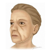 Recessed Facial Contour