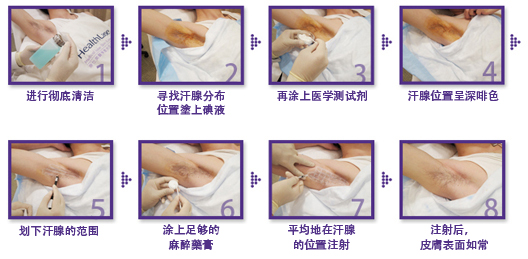 "杆菌素疗程"全面睇 (8 steps)